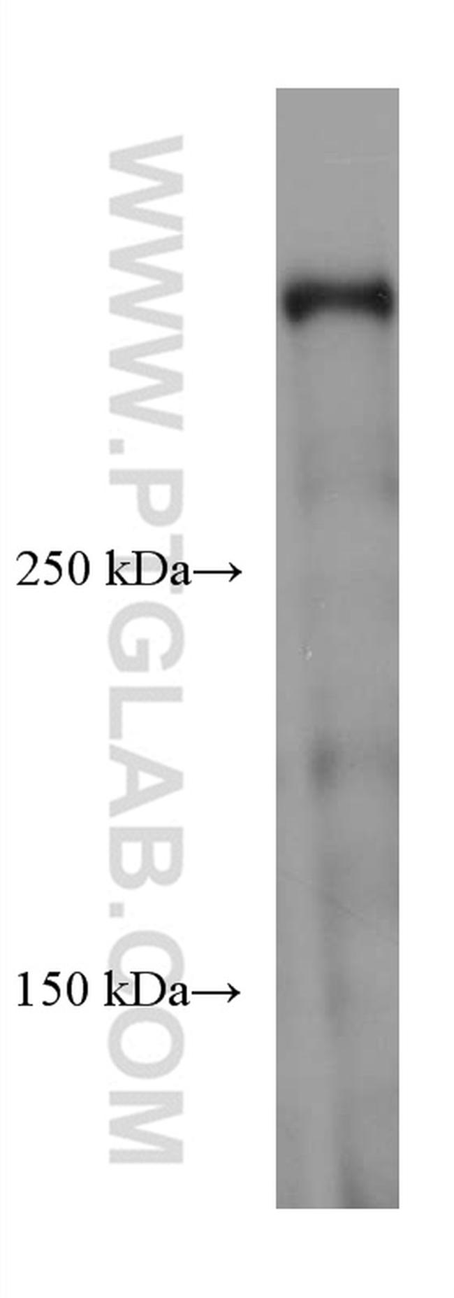 DMXL2 Antibody in Western Blot (WB)