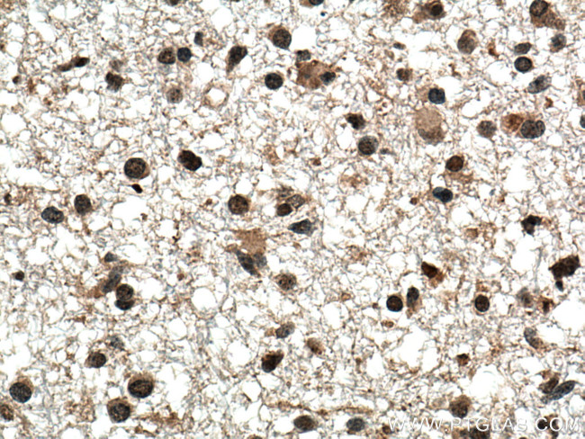 TERF2 Antibody in Immunohistochemistry (Paraffin) (IHC (P))