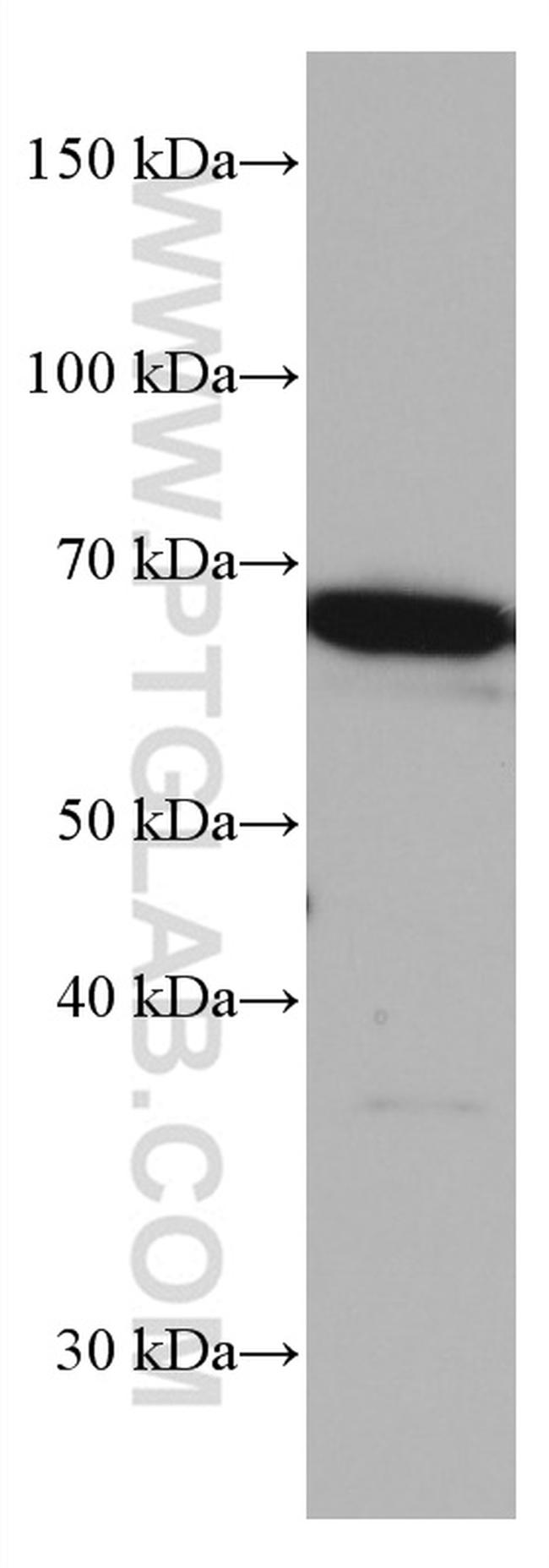 TERF2 Antibody in Western Blot (WB)