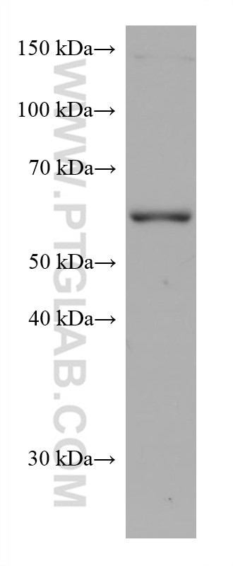 TERF2 Antibody in Western Blot (WB)