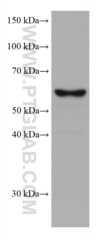 TERF2 Antibody in Western Blot (WB)