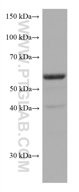 TERF2 Antibody in Western Blot (WB)