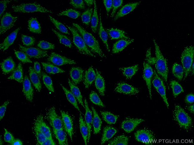 DLC1 Antibody in Immunocytochemistry (ICC/IF)