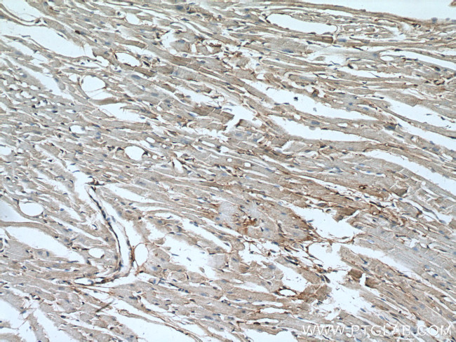 Alpha Actinin Antibody in Immunohistochemistry (Paraffin) (IHC (P))