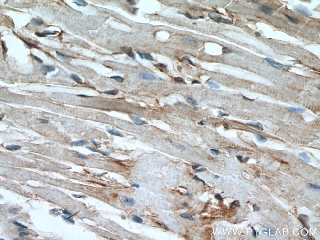 Alpha Actinin Antibody in Immunohistochemistry (Paraffin) (IHC (P))