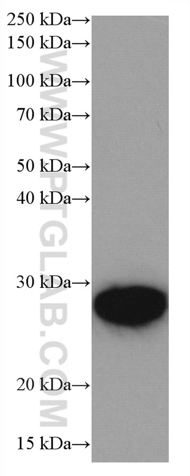 UBE2S Antibody in Western Blot (WB)