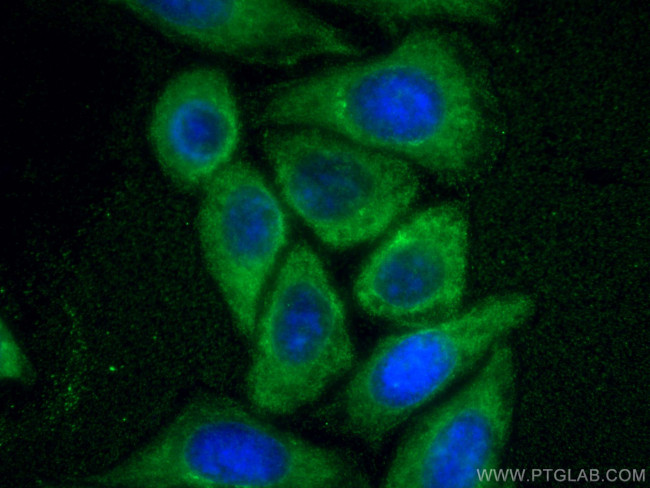 UPF1 Antibody in Immunocytochemistry (ICC/IF)