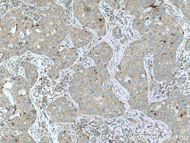 UPF1 Antibody in Immunohistochemistry (Paraffin) (IHC (P))