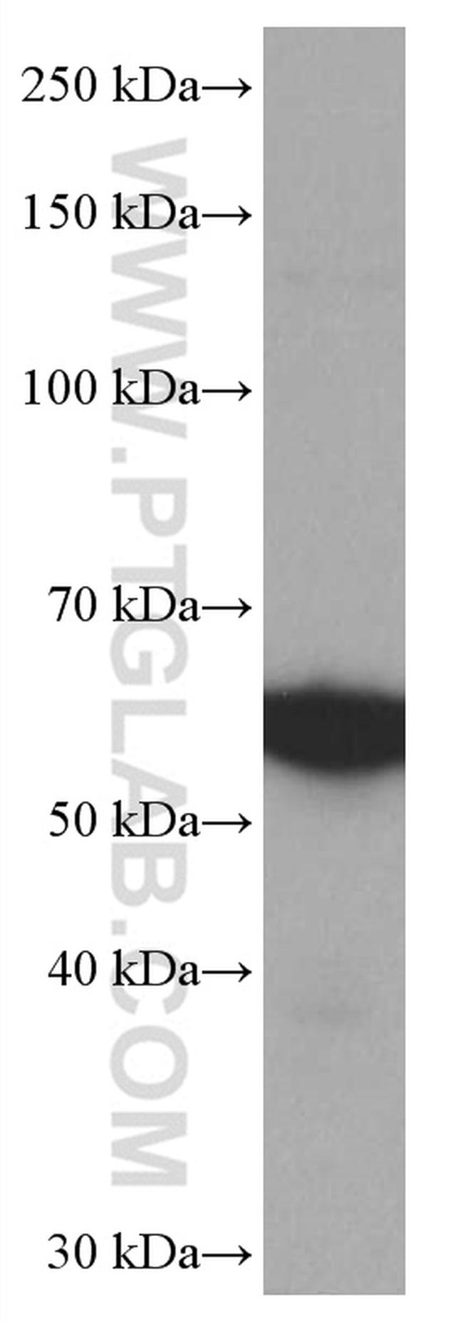 SPTLC1 Antibody in Western Blot (WB)