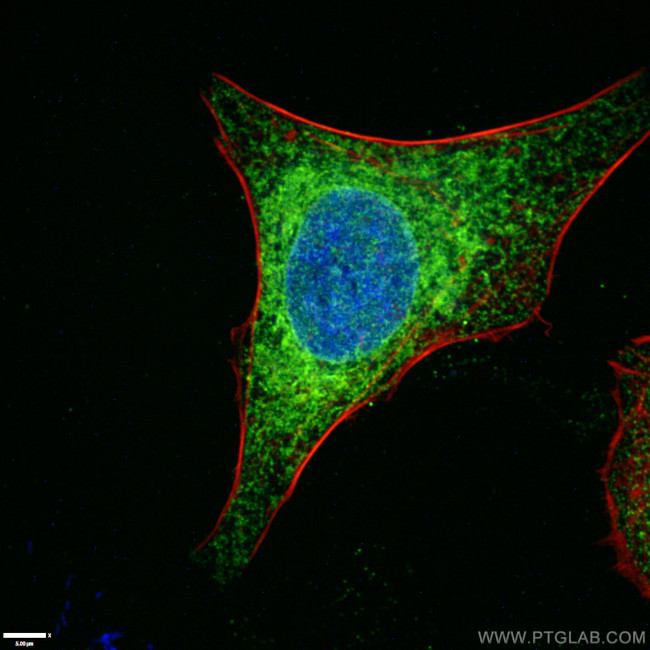 Calnexin Antibody in Immunocytochemistry (ICC/IF)