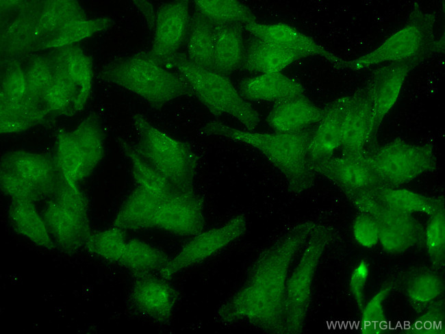 Glucocorticoid receptor Antibody in Immunocytochemistry (ICC/IF)