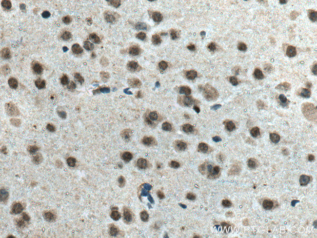 Glucocorticoid receptor Antibody in Immunohistochemistry (Paraffin) (IHC (P))