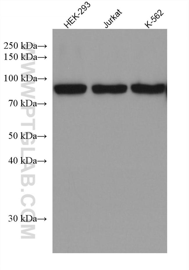 Glucocorticoid receptor Antibody in Western Blot (WB)