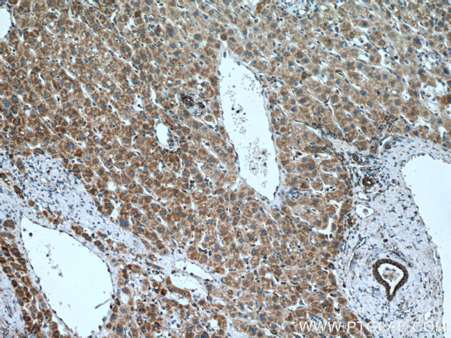 MAVS/VISA Antibody in Immunohistochemistry (Paraffin) (IHC (P))