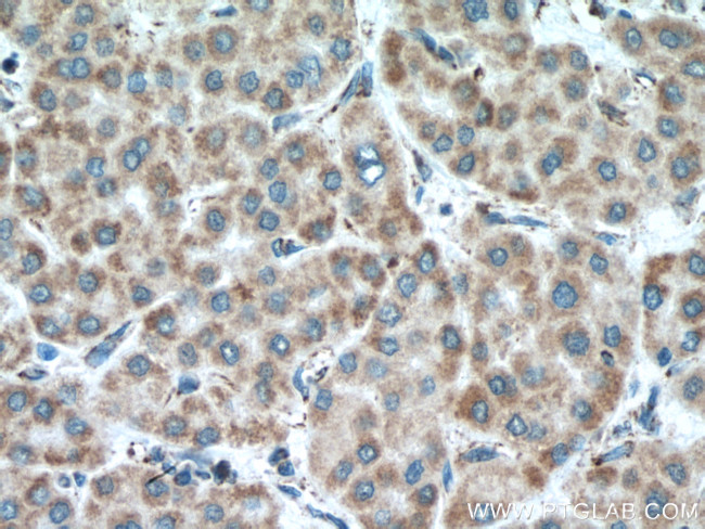 MAVS/VISA Antibody in Immunohistochemistry (Paraffin) (IHC (P))