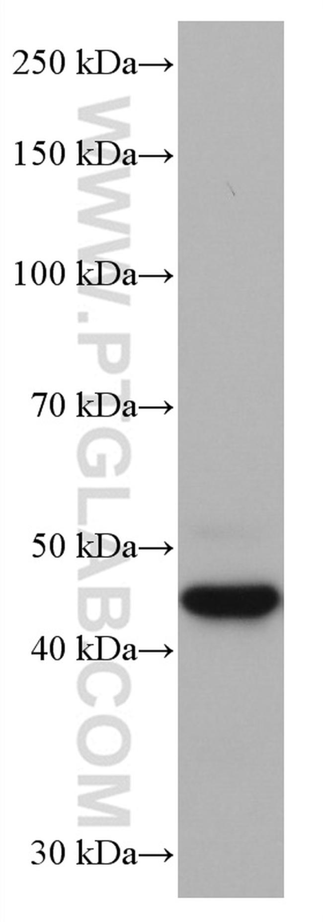 Cathepsin L Antibody in Western Blot (WB)