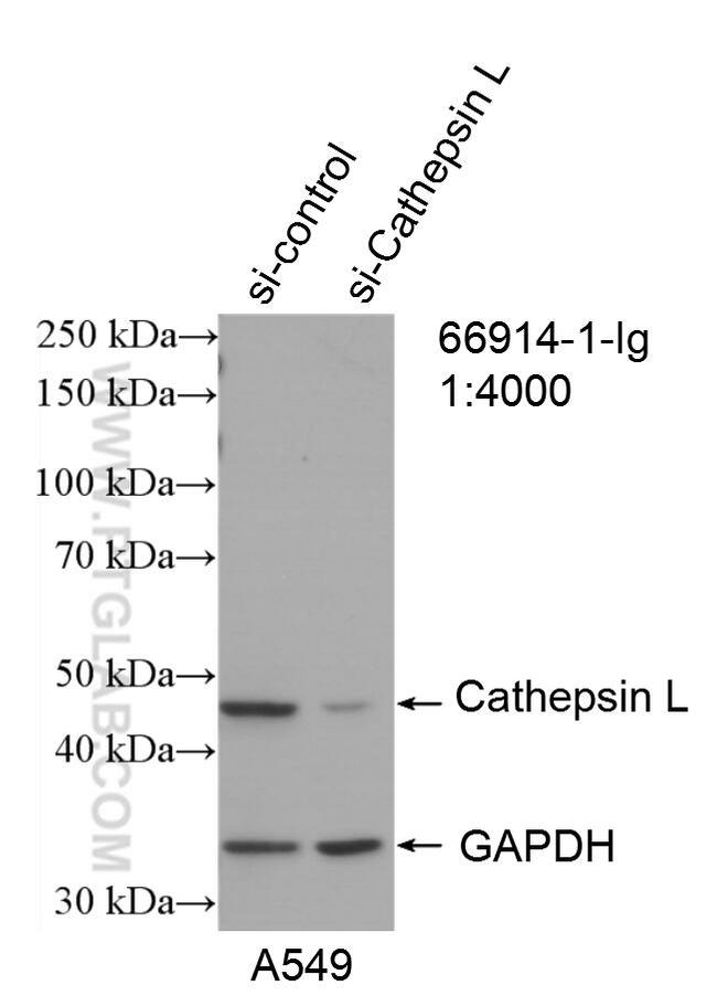 Cathepsin L Antibody in Western Blot (WB)