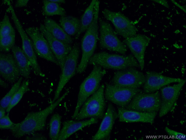 NFATC2 Antibody in Immunocytochemistry (ICC/IF)