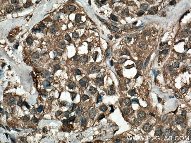 NFATC2 Antibody in Immunohistochemistry (Paraffin) (IHC (P))