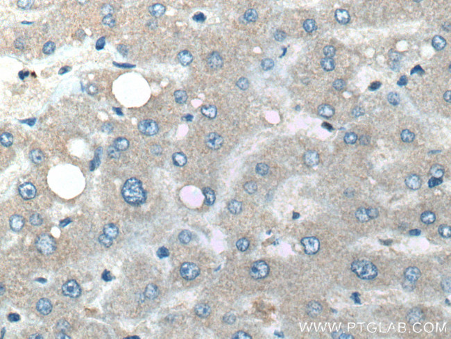 BST2 Antibody in Immunohistochemistry (Paraffin) (IHC (P))