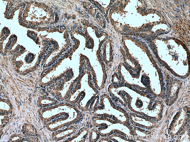 PTGER4 Antibody in Immunohistochemistry (Paraffin) (IHC (P))