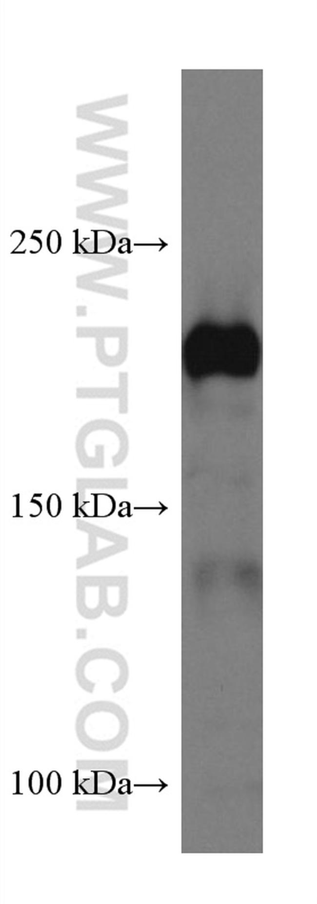 Integrin Beta 4 Antibody in Western Blot (WB)