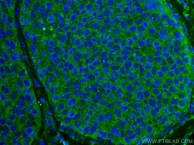 ROR1 Antibody in Immunohistochemistry (Paraffin) (IHC (P))