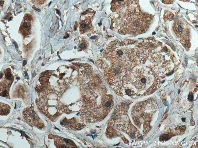 ROR1 Antibody in Immunohistochemistry (Paraffin) (IHC (P))