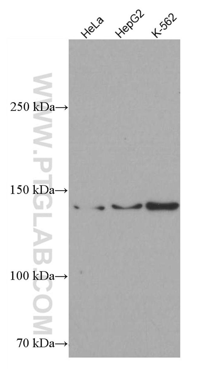 ROR1 Antibody in Western Blot (WB)