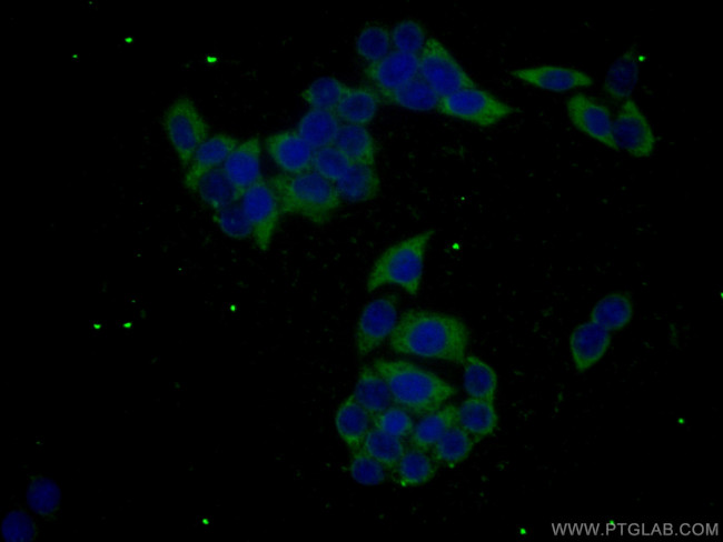 GPNMB Antibody in Immunocytochemistry (ICC/IF)