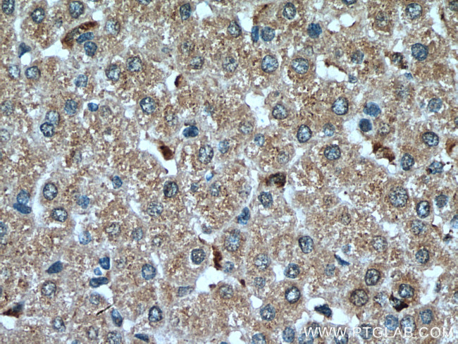 GPNMB Antibody in Immunohistochemistry (Paraffin) (IHC (P))