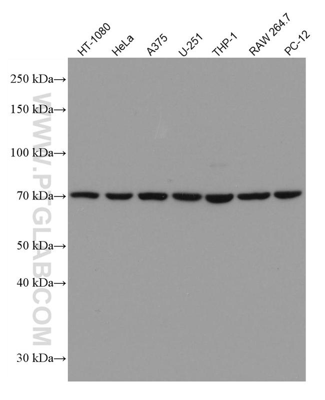 GPNMB Antibody in Western Blot (WB)