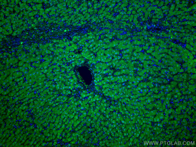 ADK Antibody in Immunohistochemistry (Paraffin) (IHC (P))