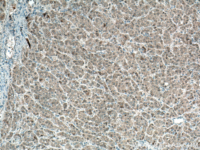 ADK Antibody in Immunohistochemistry (Paraffin) (IHC (P))