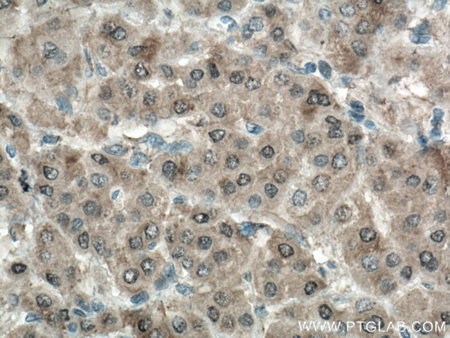 ADK Antibody in Immunohistochemistry (Paraffin) (IHC (P))