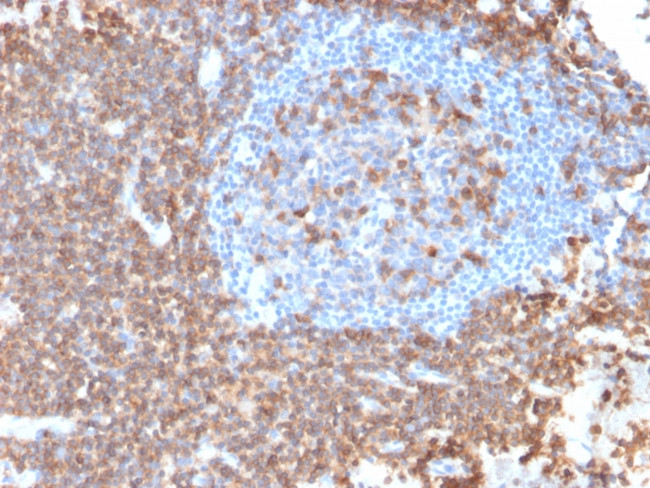 CD43 Antibody in Immunohistochemistry (Paraffin) (IHC (P))