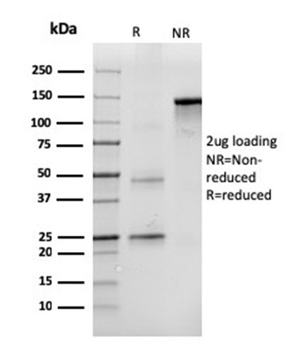 CD43 (T-Cell Marker) Antibody in SDS-PAGE (SDS-PAGE)
