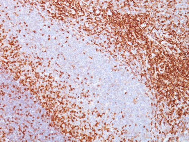 CD43 (T-Cell Marker) Antibody in Immunohistochemistry (Paraffin) (IHC (P))