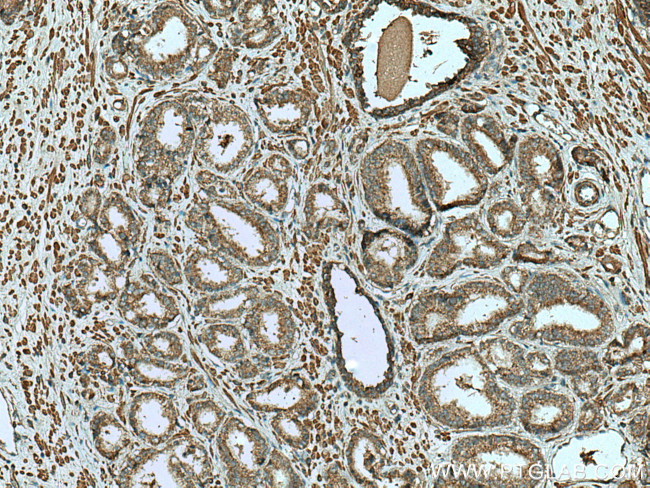 PPARG Antibody in Immunohistochemistry (Paraffin) (IHC (P))