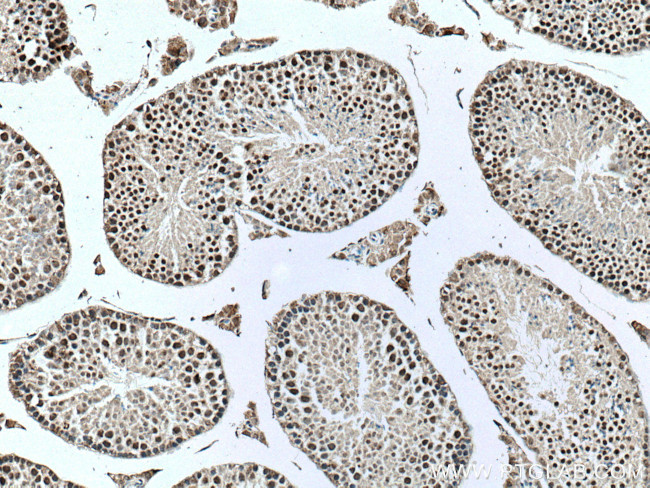 UBR5 Antibody in Immunohistochemistry (Paraffin) (IHC (P))