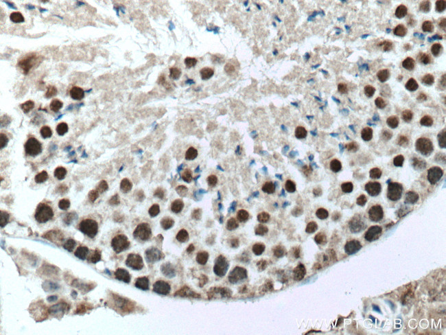 UBR5 Antibody in Immunohistochemistry (Paraffin) (IHC (P))