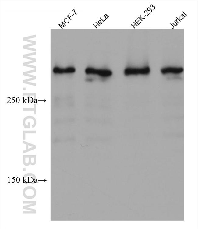 UBR5 Antibody in Western Blot (WB)