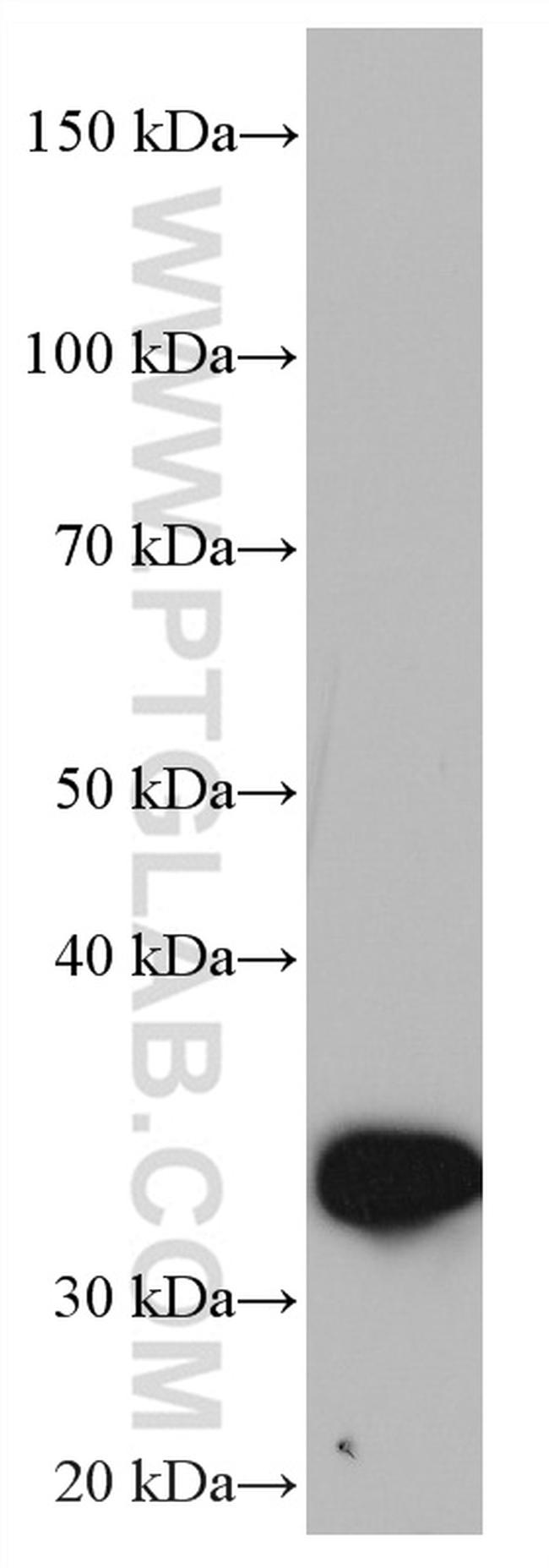 ZFP36 Antibody in Western Blot (WB)