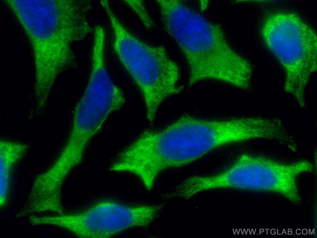 RACK1/GNB2L1 Antibody in Immunocytochemistry (ICC/IF)