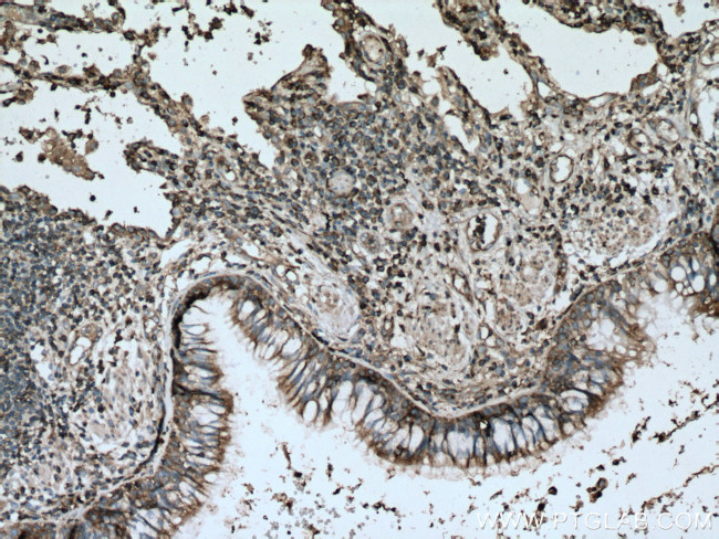 RACK1/GNB2L1 Antibody in Immunohistochemistry (Paraffin) (IHC (P))