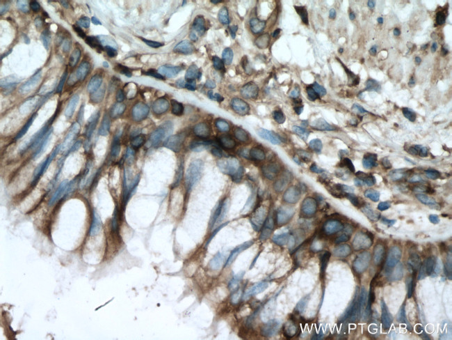 RACK1/GNB2L1 Antibody in Immunohistochemistry (Paraffin) (IHC (P))