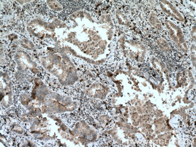 RAB27B Antibody in Immunohistochemistry (Paraffin) (IHC (P))