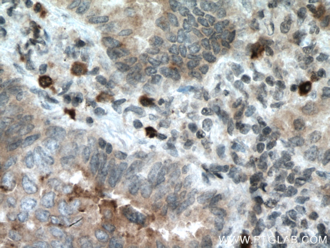 RAB27B Antibody in Immunohistochemistry (Paraffin) (IHC (P))