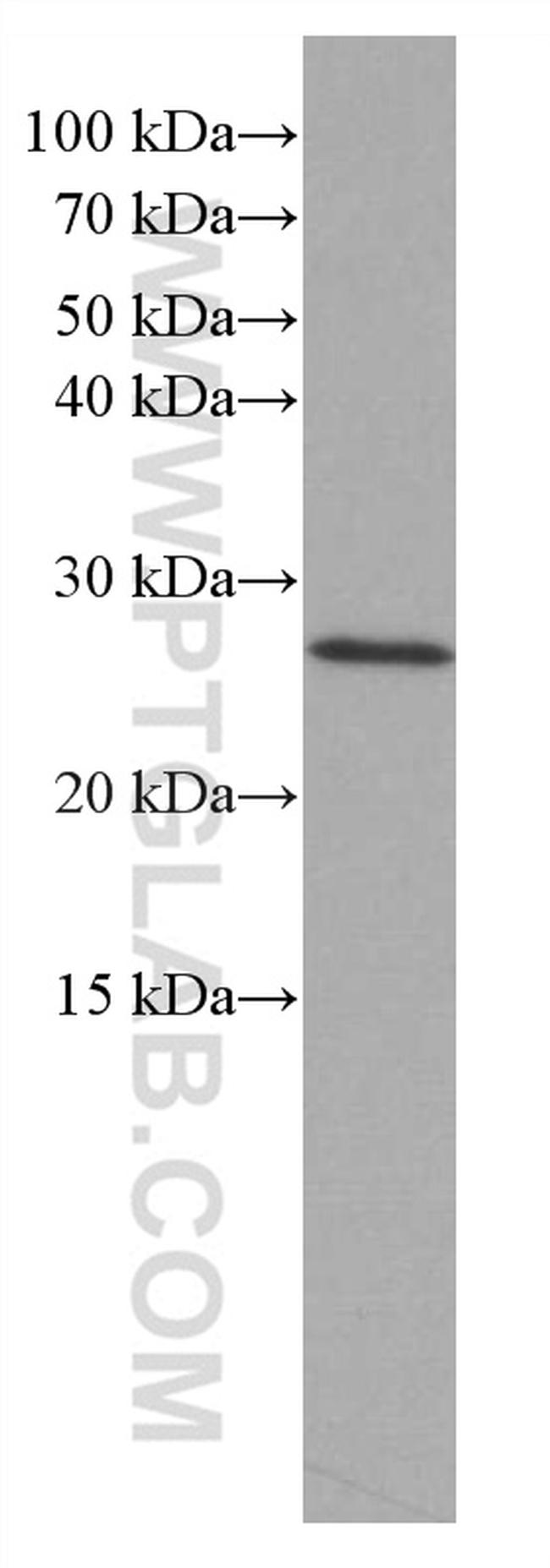 RAB27B Antibody in Western Blot (WB)