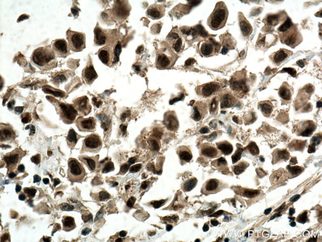 CDK4 Antibody in Immunohistochemistry (Paraffin) (IHC (P))